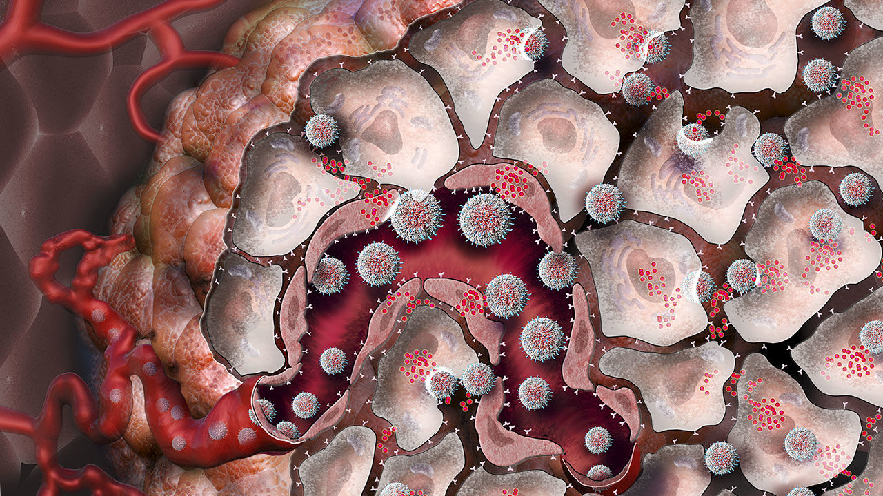 Nanoparticles awaken immune cells to fight cancer