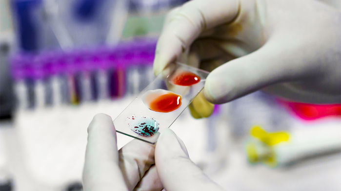 Type A blood converted to universal donor blood with help from bacterial enzymes