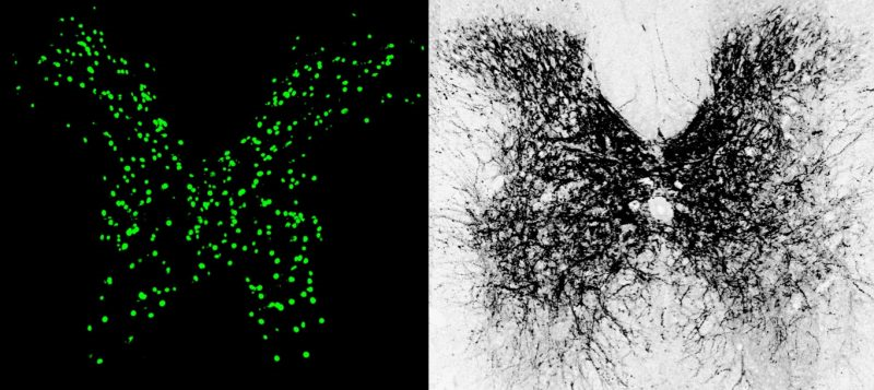 Paralyzed mice regain movement in their legs with new treatment