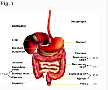 Pectin Matrix as Oral Drug Delivery Vehicle for Colon Cancer Treatment