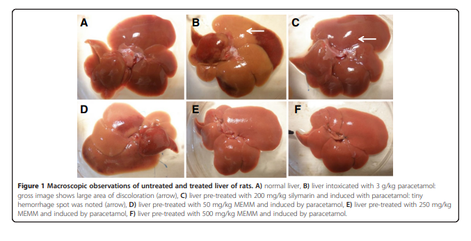 Methanol extract of Melastoma malabathricum leaves exerted antioxidant and liver protective activity 